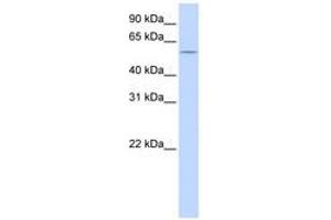 Image no. 1 for anti-HMG Box-Containing Protein 1 (HBP1) (C-Term) antibody (ABIN6740569) (HBP1 antibody  (C-Term))