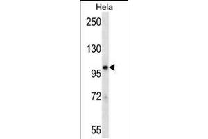 Western blot analysis in Hela cell line lysates (35ug/lane). (STAT2 antibody  (N-Term))
