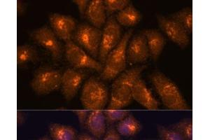 Immunofluorescence analysis of HeLa cells using B3GNT4 Polyclonal Antibody at dilution of 1:100. (B3GNT4 antibody)