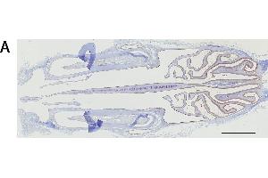 Immunohistochemistry analysis of the expression of the mu and alpha class GSTs. (GSTM1 antibody  (AA 1-218))