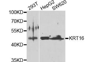Western blot analysis of extracts of various cell lines, using KRT16 antibody (ABIN5975146) at 1/1000 dilution. (KRT16 antibody)