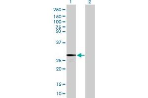 Western Blot analysis of FKBP7 expression in transfected 293T cell line by FKBP7 MaxPab polyclonal antibody. (FKBP7 antibody  (AA 1-222))