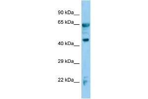 Host:  Rabbit  Target Name:  Adh7  Sample Type:  Mouse Lung lysates  Antibody Dilution:  1. (ADH7 antibody  (C-Term))