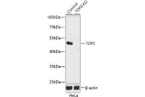 Western blot analysis of extracts from normal (control) and TDP2 knockout (KO) HeLa cells using TDP2 Polyclonal Antibody at dilution of 1:3000.