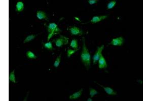 Immunofluorescence staining of U251 cells with ABIN7174328 at 1:166, counter-stained with DAPI. (USP4 antibody  (AA 632-810))