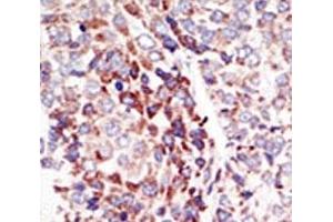 Immunohistochemistry (IHC) image for anti-TEK Tyrosine Kinase, Endothelial (TEK) (AA 758-789) antibody (ABIN3029103)
