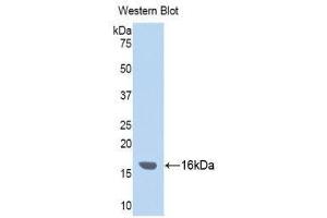 Western Blotting (WB) image for anti-Inter alpha Globulin Inhibitor H4 (ITIH4) (AA 273-424) antibody (ABIN3201788) (ITIH4 antibody  (AA 273-424))