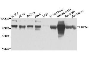 Western blot analysis of extracts of various cell lines, using HSPA2 antibody. (HSPA2 antibody  (AA 400-639))