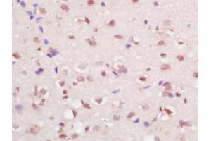 Formalin-fixed and paraffin embedded at brain labeled with Anti-RFX4 Polyclonal Antibody, Unconjugated (ABIN1386336) at 1:200 followed by conjugation to the secondary antibody and DAB staining (RFX4 antibody  (AA 101-200))