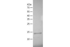 Western Blotting (WB) image for Bromodomain and PHD Finger Containing, 1 (BRPF1) (AA 628-746) protein (His tag) (ABIN7286511) (BRPF1 Protein (AA 628-746) (His tag))