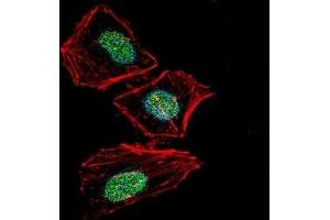 Immunofluorescence (IF) image for anti-X-Ray Repair Complementing Defective Repair in Chinese Hamster Cells 6 (XRCC6) (AA 521-548) antibody (ABIN3029655)