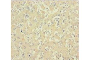 Immunohistochemistry (IHC) image for anti-C1D Nuclear Receptor Corepressor (C1D) (AA 1-135) antibody (ABIN7161811)