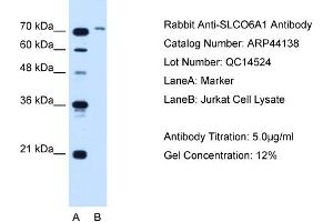 WB Suggested Anti-SLCO6A1  Antibody Titration: 5. (SLCO6A1 antibody  (N-Term))