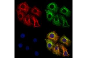 ABIN6265121 and ABIN6273320 staining Hela cells by IF/ICC.