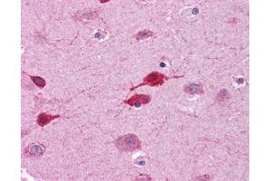WNT5A antibody was used for immunohistochemistry at a concentration of 4-8 ug/ml. (WNT5A antibody  (Middle Region))