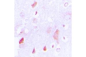 Immunohistochemical analysis of HCCS staining in human brain formalin fixed paraffin embedded tissue section. (HCCS antibody  (Center))