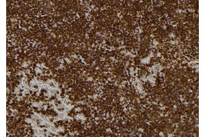 ABIN6273521 at 1/100 staining Mouse spleen tissue by IHC-P. (PMS1 antibody  (Internal Region))