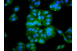 Immunofluorescence staining of HepG2 cells with ABIN7165258 at 1:133, counter-stained with DAPI. (DEPP1 (AA 57-174) antibody)