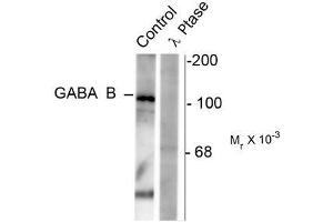 Image no. 1 for anti-gamma-aminobutyric Acid (GABA) B Receptor, 1 (GABBR1) (pSer923) antibody (ABIN372645) (GABBR1 antibody  (pSer923))