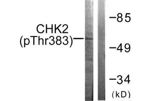 Western blot analysis of extracts from COS7 cells treated with UV using Chk2 (Phospho-Thr383) Antibody. (CHEK2 antibody  (pThr383))