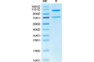 Human Complement C5 on Tris-Bis PAGE under reduced condition. (C5 Protein (AA 19-1676) (His tag))