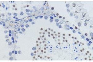 Immunohistochemistry of paraffin-embedded Mouse testis using MonoMethyl-Histone H4-K20 Polyclonal Antibody at dilution of 1:200 (40x lens). (Histone H4 antibody  (meLys20))