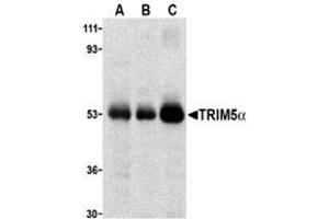 Western blot analysis of TRIM5 alpha expression in human stomach (A), thymus (B), and uterus (C) cell lysate with this product at 2 μg /ml.