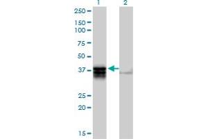 Western Blot analysis of TRDD3 expression in transfected 293T cell line by TRDD3 MaxPab polyclonal antibody. (TRDD3 antibody  (AA 1-296))
