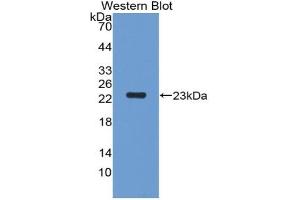 Detection of Recombinant PGLYRP1, Rat using Polyclonal Antibody to Peptidoglycan Recognition Protein 1 (PGLYRP1)