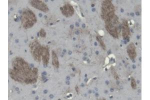 DAB staining on IHC-P; Samples: Mouse Cerebrum Tissue (Cnpase antibody  (AA 110-365))