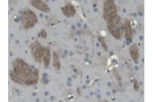 DAB staining on IHC-P; Samples: Mouse Cerebrum Tissue (Cnpase antibody  (AA 110-365))