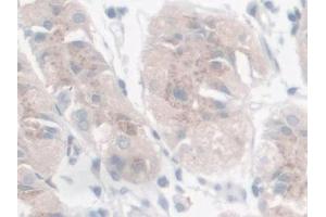 Detection of GAL9 in Human Stomach Tissue using Polyclonal Antibody to Galectin 9 (GAL9) (Galectin 9 antibody  (AA 1-323))