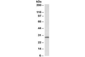 Western blot testing of human skin lysate with 14-3-3 sigma antibody at 0. (14-3-3 sigma/SFN antibody)
