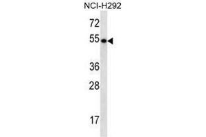 TBC1D3E Antibody (C-term) western blot analysis in NCI-H292 cell line lysates (35µg/lane). (TBC1D3E (AA 497-527), (C-Term) antibody)