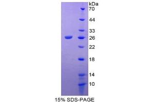 SDS-PAGE (SDS) image for Tachykinin Receptor 2 (TACR2) (AA 1-200) protein (His tag) (ABIN2126911)