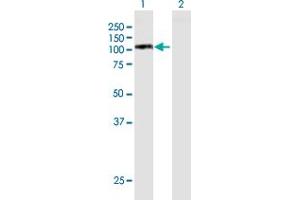 Western Blotting (WB) image for anti-Minichromosome Maintenance Complex Component 6 (MCM6) (AA 1-821) antibody (ABIN517783)
