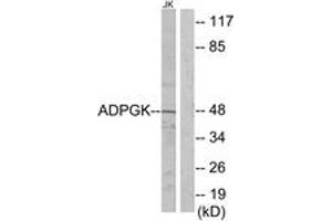 Western blot analysis of extracts from Jurkat cells, using ADPGK Antibody. (ADPGK antibody  (AA 241-290))