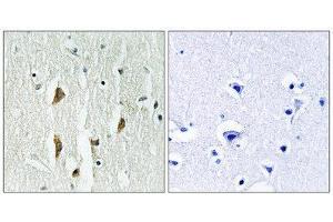 Immunohistochemistry (IHC) image for anti-P21-Activated Kinases 1/2/3 (PAK1/2/3) (Thr402), (Thr421), (Thr423) antibody (ABIN1847964) (PAK1/2/3 antibody  (Thr402, Thr421, Thr423))