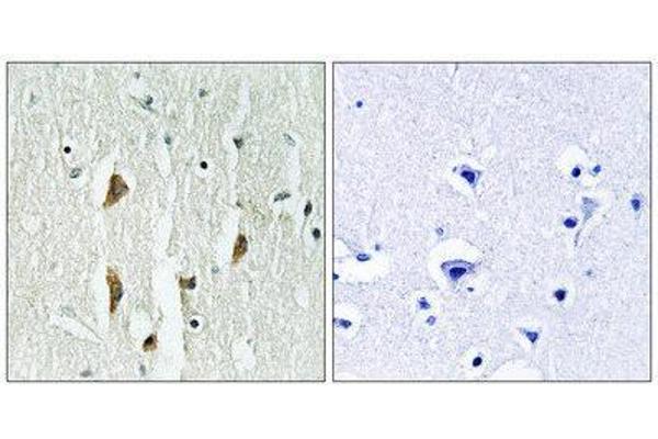 PAK1/2/3 antibody  (Thr402, Thr421, Thr423)