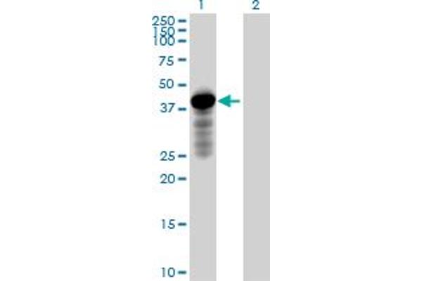HOMER2 Antikörper  (AA 1-343)