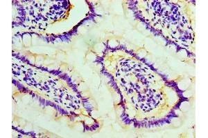 Immunohistochemistry of paraffin-embedded human small intestine tissue using ABIN7170819 at dilution of 1:100 (STIP1 antibody  (AA 1-543))