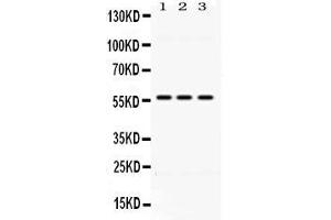 Western Blotting (WB) image for anti-Aldehyde Dehydrogenase 1 Family, Member B1 (ALDH1B1) (AA 116-156), (N-Term) antibody (ABIN4886450)