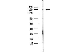 anti-Ataxin 2 (ATXN2) (Internal Region) antibody