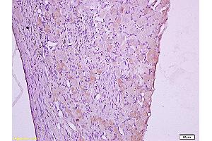 Formalin-fixed and paraffin embedded: rat spinal cord tissue labeled with Anti-Dnmt-3-beta Polyclonal Antibody (ABIN727623), Unconjugated at 1:600, followed by conjugation to the secondary antibody and DAB staining (DNMT3B antibody  (AA 1-80))