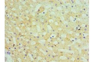 Immunohistochemistry of paraffin-embedded human liver tissue using ABIN7154176 at dilution of 1:100 (GATM antibody  (AA 124-423))