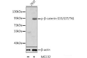 Western blot analysis of extracts of 293T cells using Phospho-β-catenin(S33/S37/T41) Polyclonal Antibody. (beta Catenin antibody  (pSer33, pSer37, pThr41))