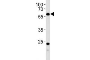 Western blot analysis of lysate from human kidney tissue using PFKFB3 antibody at 1:1000. (PFKFB3 antibody  (AA 454-484))