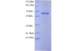 SDS-PAGE (SDS) image for Cyclin-Dependent Kinase 2 Associated Protein 1 (CDK2AP1) (AA 1-115), (full length) protein (GST tag) (ABIN5709261)
