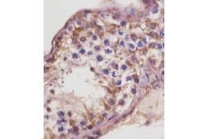 (ABIN6243319 and ABIN6578857) staining TGFBR3 in human testis tissue sections by Immunohistochemistry (IHC-P - paraformaldehyde-fixed, paraffin-embedded sections). (TGFBR3 antibody  (AA 285-319))