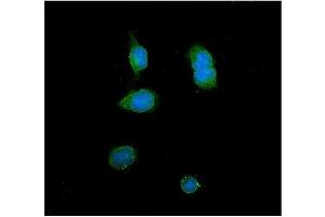 IF analysis of ITLN1 using anti-ITLN1 antibody (ABIN4886644). (ITLN1/Omentin antibody  (N-Term))